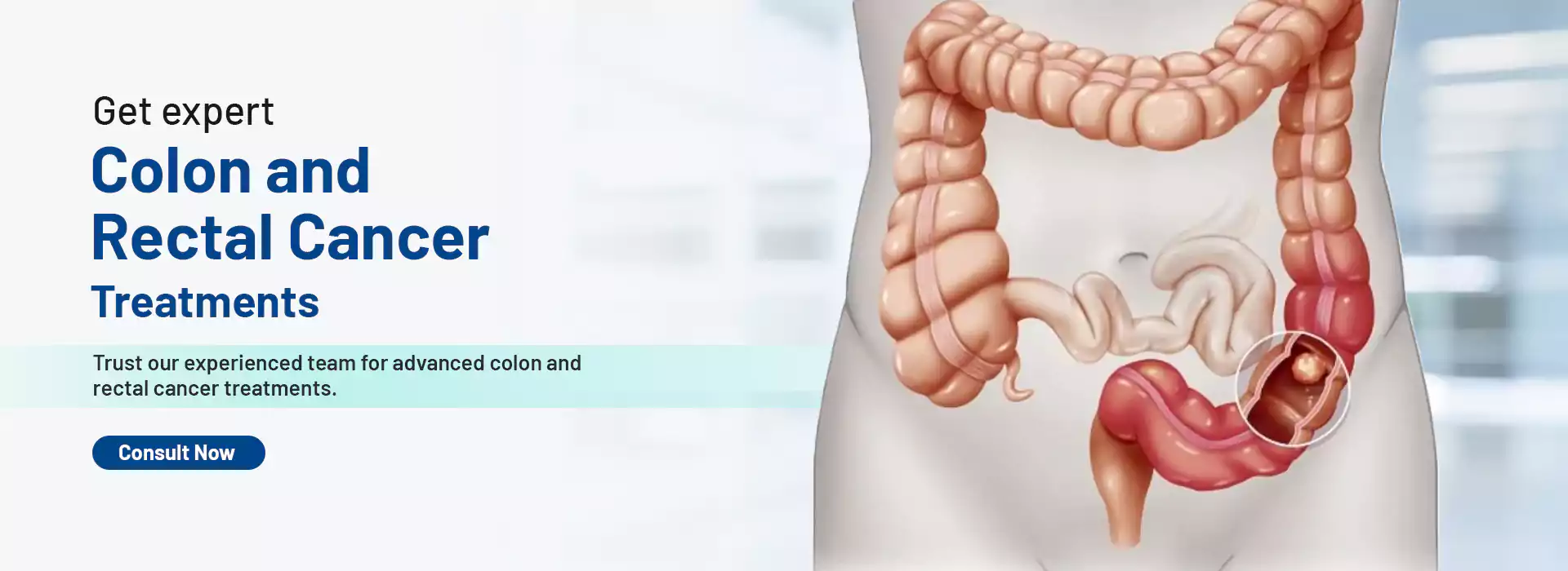Robotic Surgery in Electronic City
