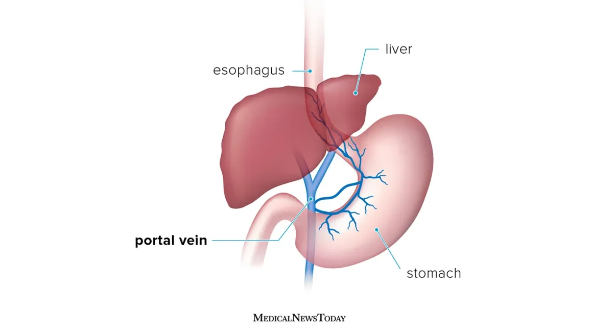 Splenectomy Surgery in Electronic City