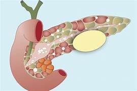 Expert Transplant Surgeon in Electronic CityExpert Transplant Surgeon in Electronic City