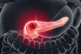 Expert Transplant Surgeon in Electronic CityExpert Transplant Surgeon in Electronic City
