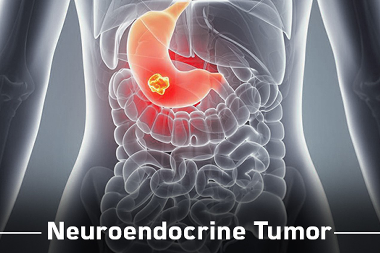 Expert Transplant Surgeon in Electronic CityExpert Transplant Surgeon in Electronic City