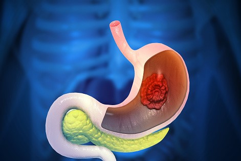 Expert Transplant Surgeon in Electronic CityExpert Transplant Surgeon in Electronic City
