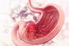 Expert Transplant Surgeon in Electronic CityExpert Transplant Surgeon in Electronic City