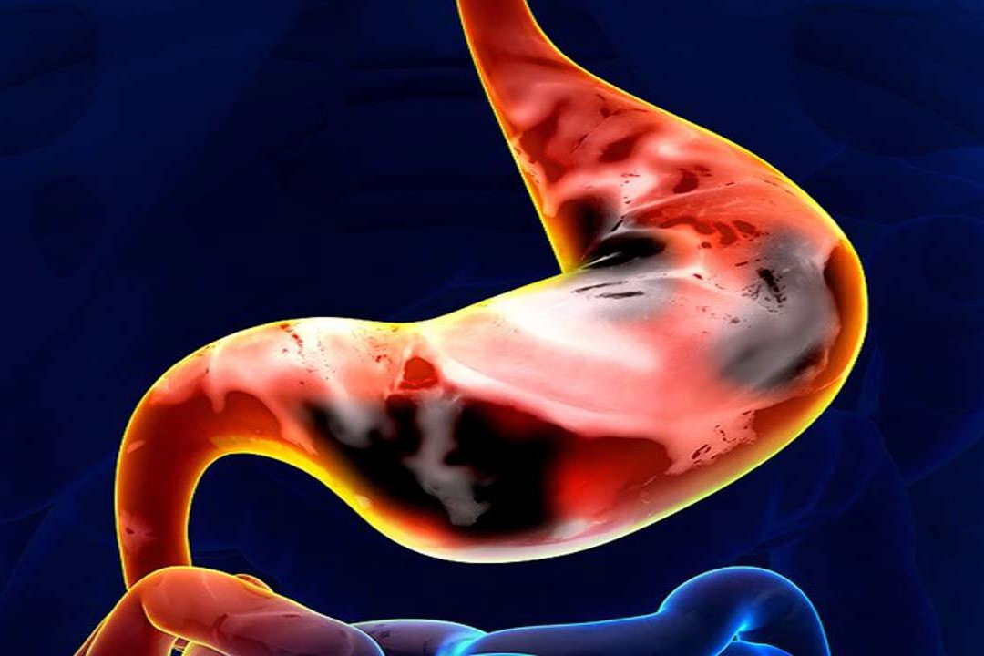 Expert Transplant Surgeon in Electronic CityExpert Transplant Surgeon in Electronic City