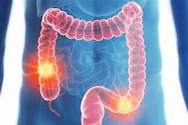 Expert Transplant Surgeon in Electronic CityExpert Transplant Surgeon in Electronic City
