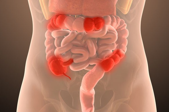 Expert Transplant Surgeon in Electronic CityExpert Transplant Surgeon in Electronic City