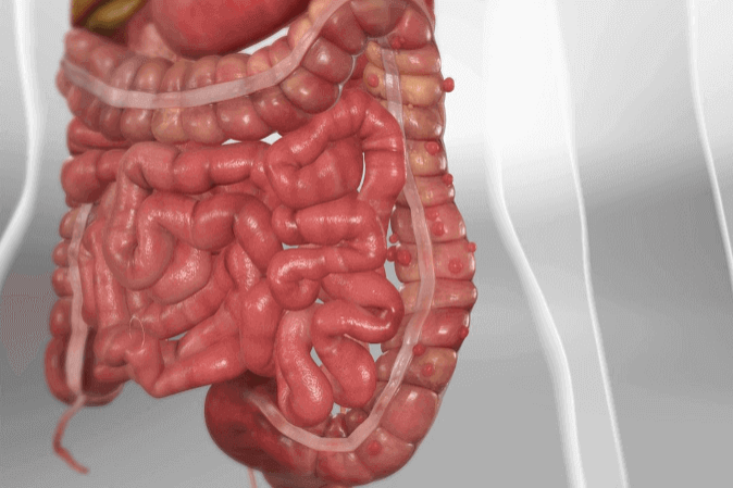 Expert Transplant Surgeon in Electronic CityExpert Transplant Surgeon in Electronic City