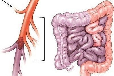 Expert Transplant Surgeon in Electronic CityExpert Transplant Surgeon in Electronic City