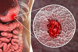 Expert Transplant Surgeon in Electronic CityExpert Transplant Surgeon in Electronic City