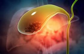 Expert Transplant Surgeon in Electronic CityExpert Transplant Surgeon in Electronic City