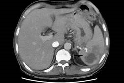 Expert Transplant Surgeon in Electronic CityExpert Transplant Surgeon in Electronic City