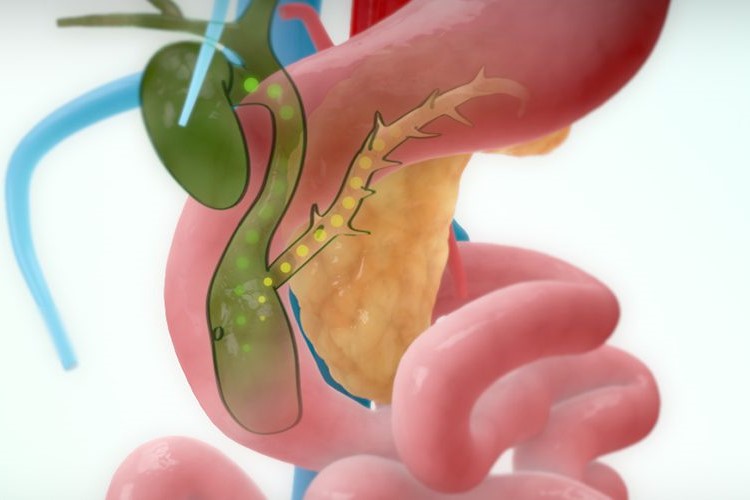 Expert Transplant Surgeon in Electronic CityExpert Transplant Surgeon in Electronic City