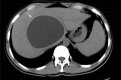 Expert Transplant Surgeon in Electronic CityExpert Transplant Surgeon in Electronic City