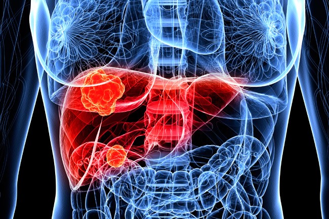 Expert Transplant Surgeon in Electronic CityExpert Transplant Surgeon in Electronic City