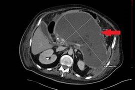Expert Transplant Surgeon in Electronic CityExpert Transplant Surgeon in Electronic City