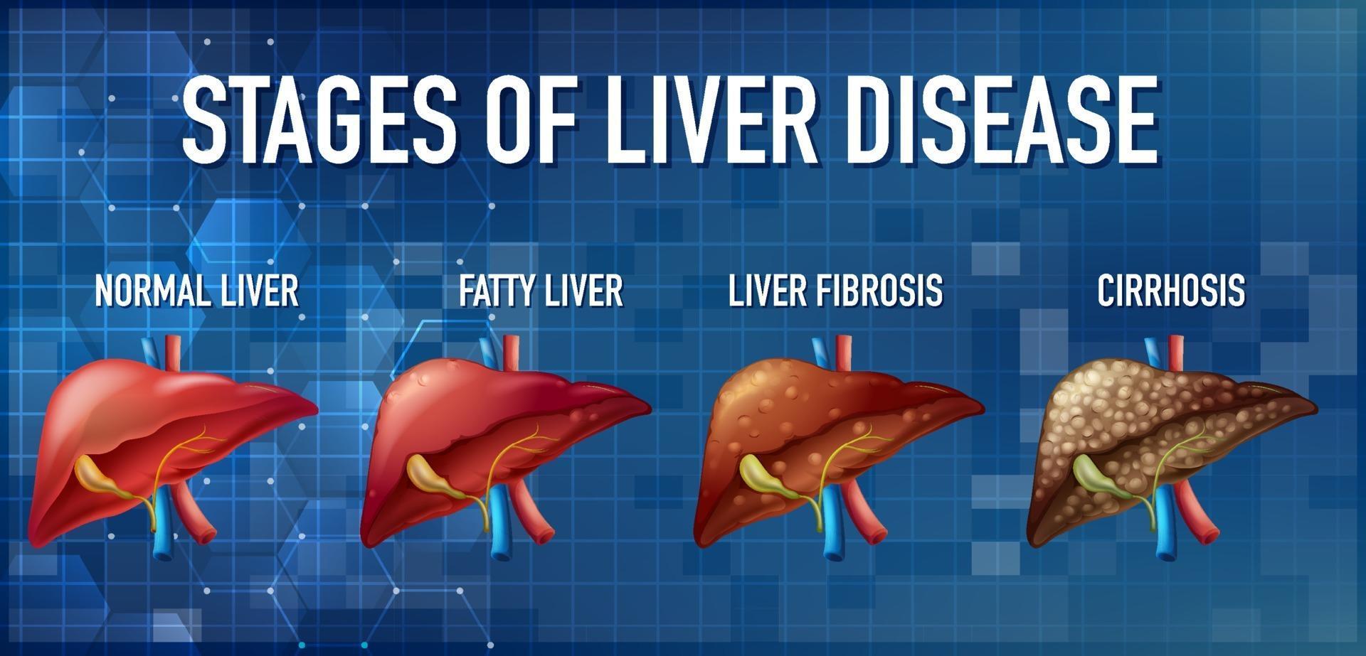 Liver Tumor Treatment in Electronic City